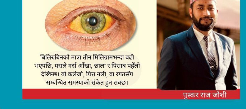 जन्डिस भनेको के हो ? जन्डिस हुँदा के खाने, के नखाने ? 